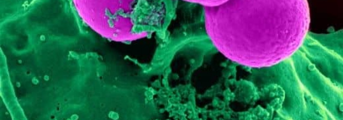 درمان عفونت‌های باکتریایی با استفاده از فناوری نانو