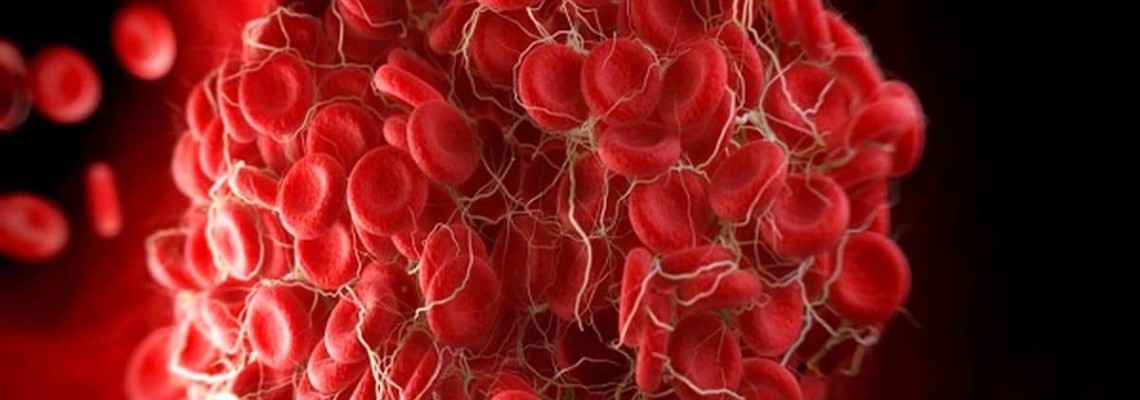 تخریب لخته های خونی با استفاده از نانو ذرات مغناطیسی