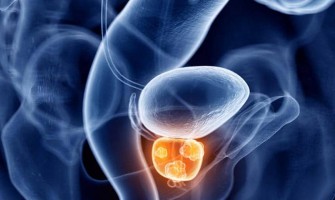 تولید نانو حامل‌ داروی سرطان پروستات