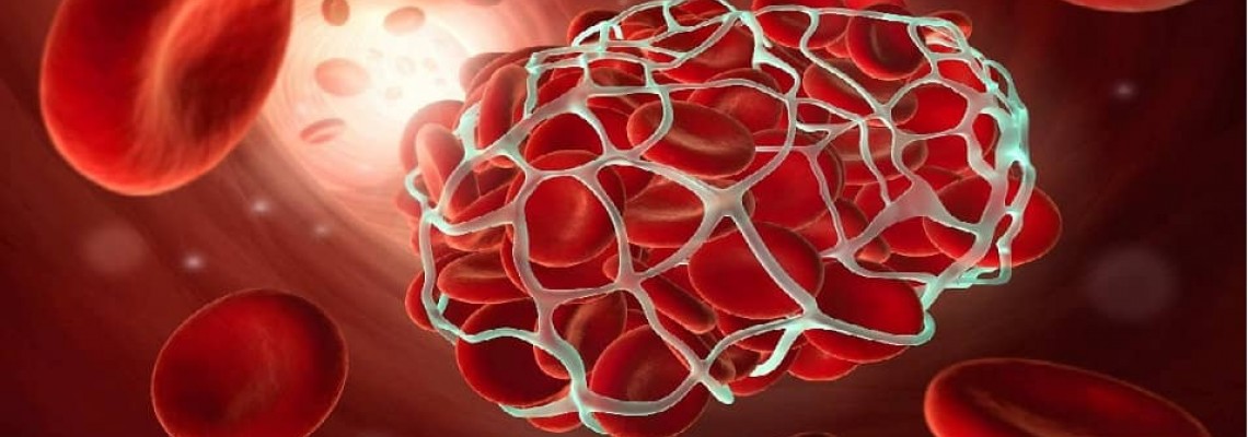 توقف خونریزی‌های داخلی به کمک نانو ذرات