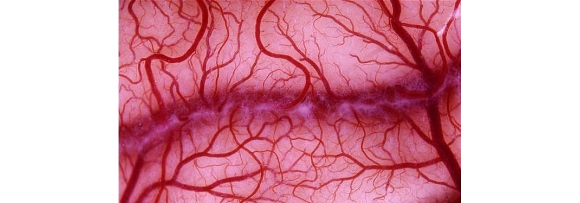 استفاده از نانوسوزن برای رشد رگ های خونی جدید در بدن