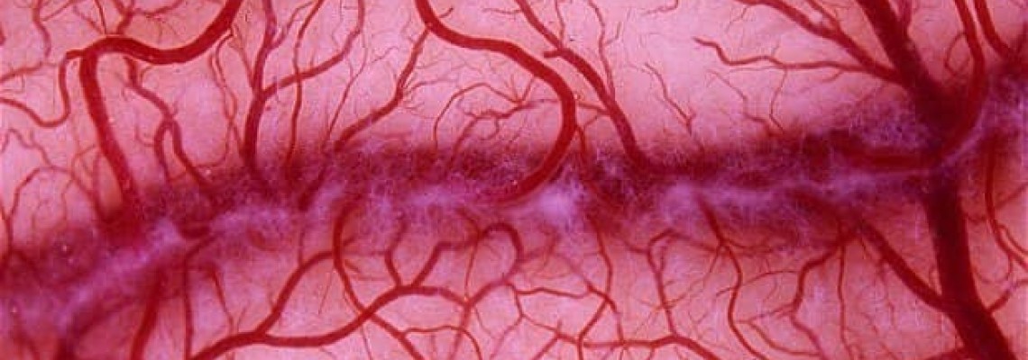استفاده از نانوسوزن برای رشد رگ های خونی جدید در بدن